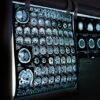 Lille : une IRM révolutionnaire pour des diagnostics ultra-précis !