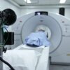 Cancer du poumon : l&rsquo;Auvergne-Rhône-Alpes lance le dépistage gratuit pour sauver des vies