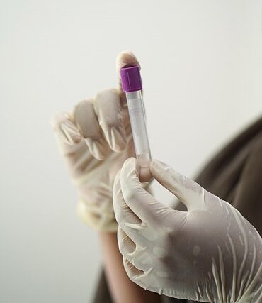 Incident radiologique aux HCL : un employé exposé à Bron
